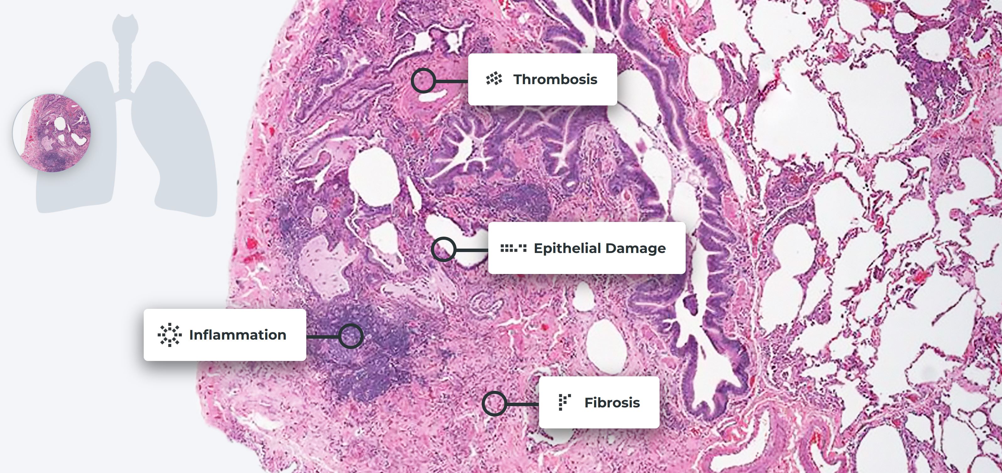 lung-damage