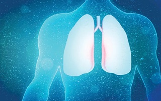 pulmonary-fibrosis-lungs